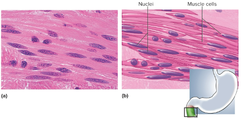 <p>Smooth muscle</p>