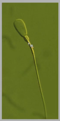 <p>What is an indicator of sperm in the caput epididymis?</p>