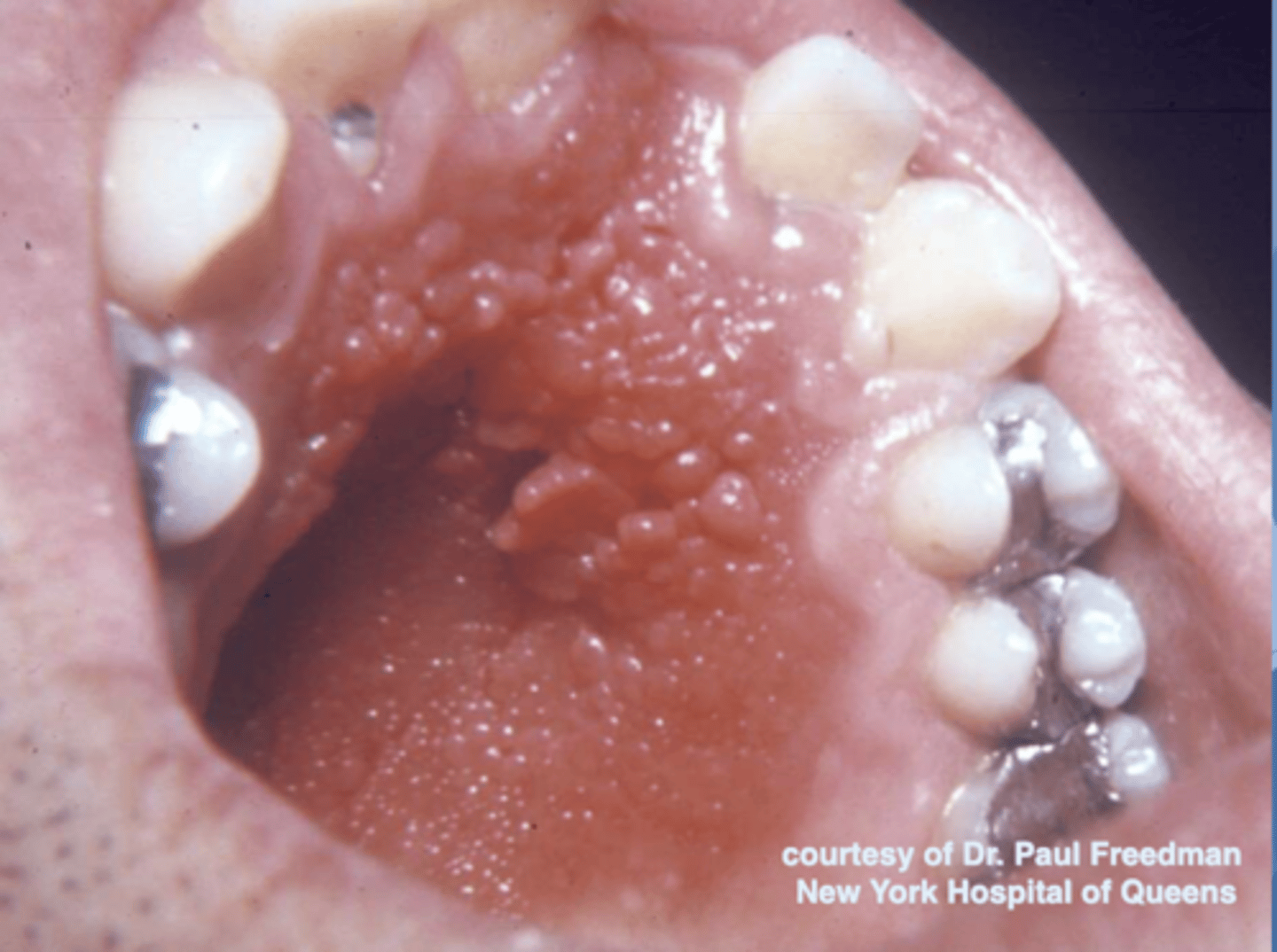 <p>what do you suspect?</p>