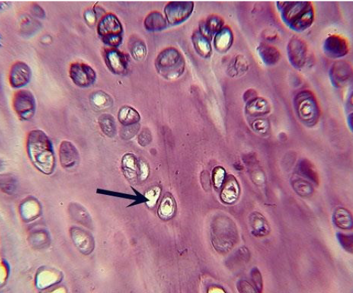 <ul><li><p>glassy, homogenous appearing matrix</p></li><li><p>very fine <strong>collagen fiber</strong></p></li><li><p>covers the <strong>articulating (contact) surfaces of bones</strong>, reinforces the tip of the</p></li></ul><p><strong>nose</strong>, and provides<strong> attachment of the ribs to the sternum</strong></p><p></p>