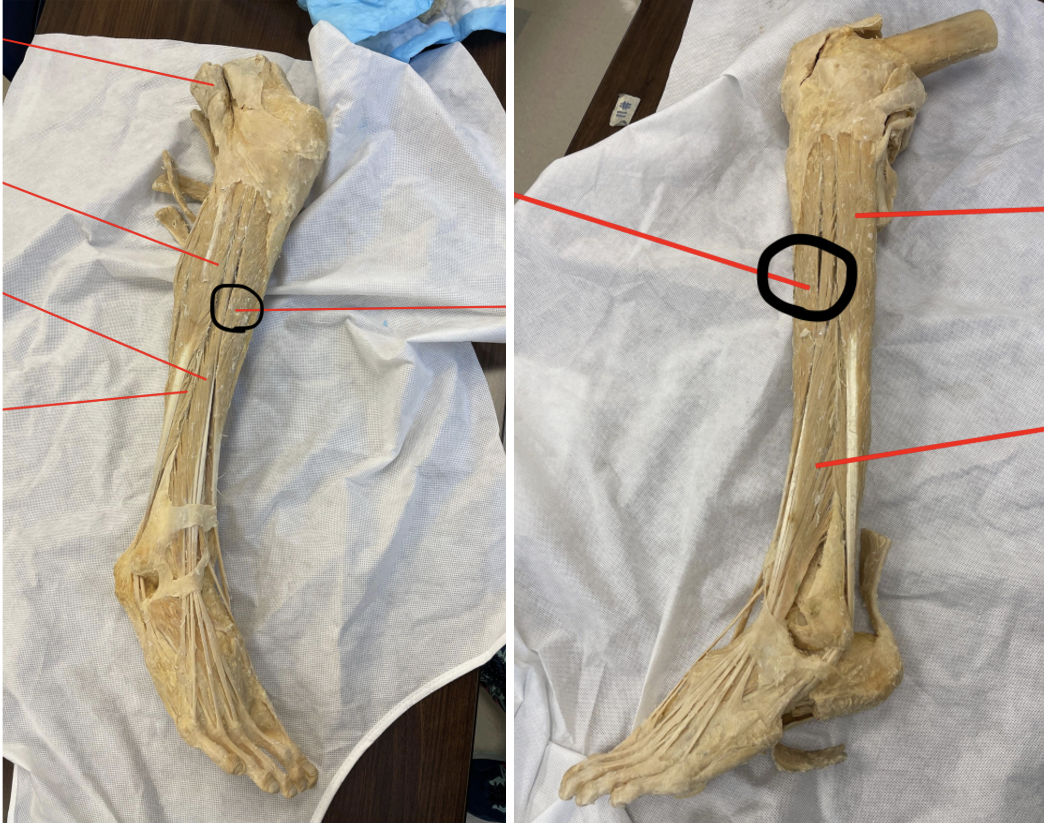 <p>identify + state origin, insertion, action, innervation of marked structure</p>
