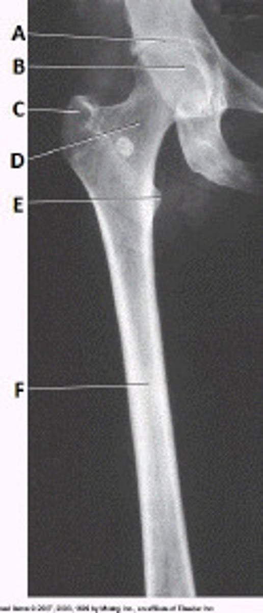 <p>greater trochanter</p>