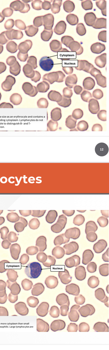 Which cell is this?
