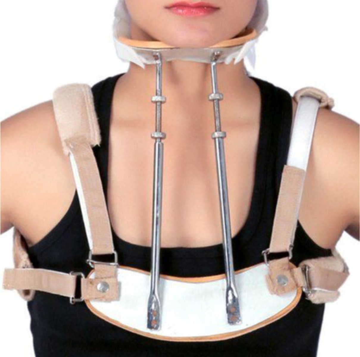 <p>cervical spine affection</p>