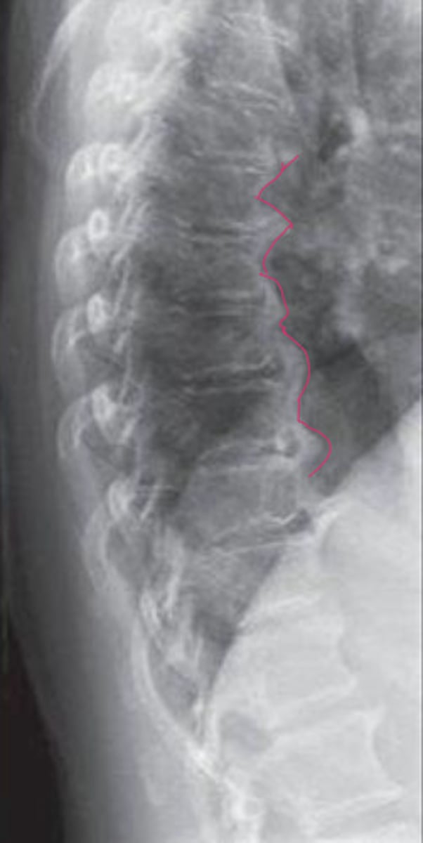 <p>What is in the red?</p>