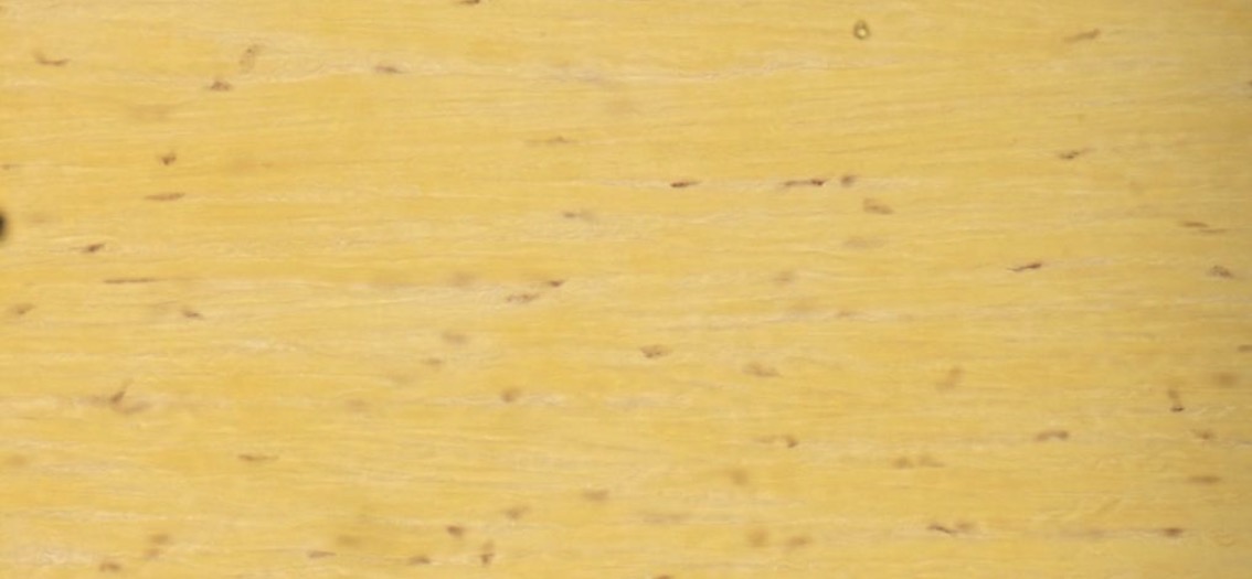 <ul><li><p>Elastines skaidulos</p></li><li><p>Tarpus užpildo kolageno ir tinklinės skaidulos, fibroblastocitai ir fibrocitai</p></li><li><p>Pagr medziagos nedaug (del to nesimato baltu ertmiu nes jas uzpildo skaidulos)</p></li></ul><p></p>