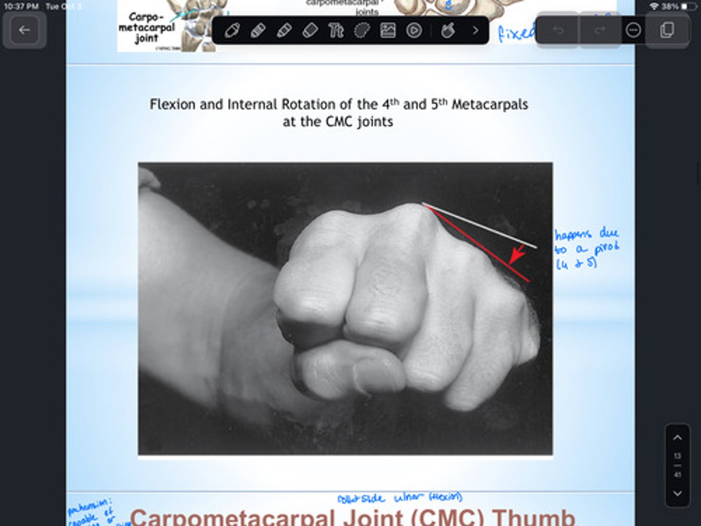 <p>False!</p><p>2nd and 3rd are immobile</p><p>4th and 5th have 10-20 deg of flexion</p>
