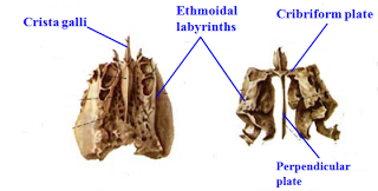 <p>horizontal portion of ethmoid bone</p>