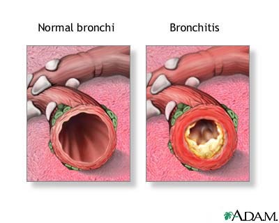 <p>suffering from a disease for a long period of time</p>