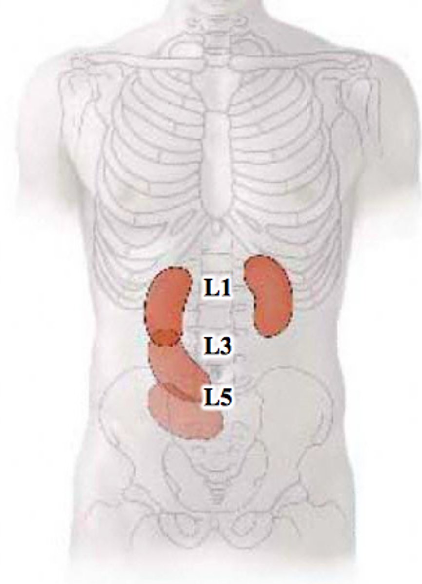<p>tillstånd där njuren sjunker mer än två kotkroppar eller 5 centimeter när en person går från att ligga ner till att stå upp</p>