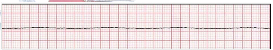 <p>What rhythm is this called?</p>