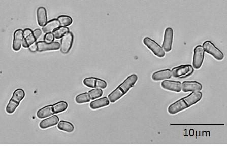 <p>Schizosaccharomyces</p>