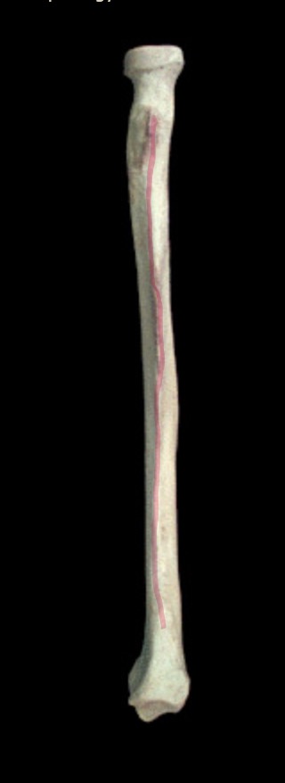 <p>What structure is this?</p>