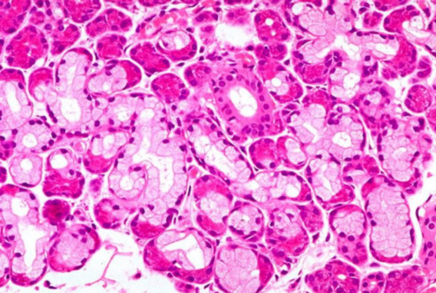 <p>what type of secretions do you expect from this gland?</p>