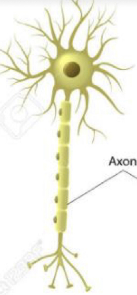 What type of neuron is this?