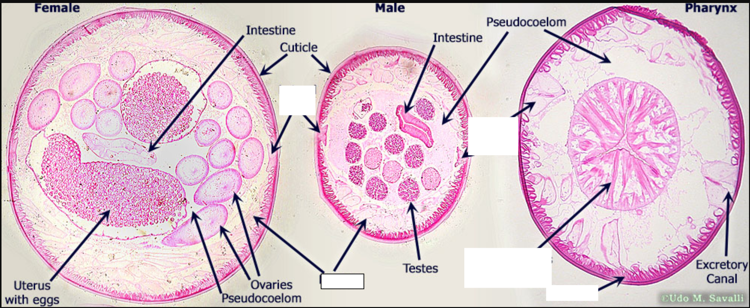 <p>Phylum Nematoda.<em> Ascaris</em></p>
