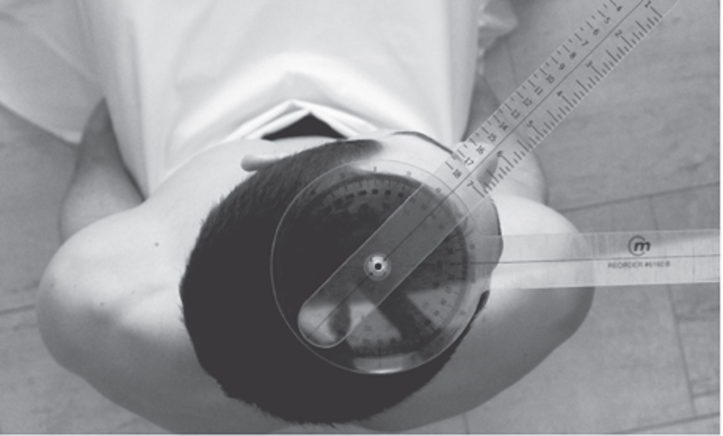 <p>fulcrum: center of cranial aspect of head<br>proximal: parallel to imaginary line between acromion process<br>distal: tip of nose<br><br>normal = 60</p>
