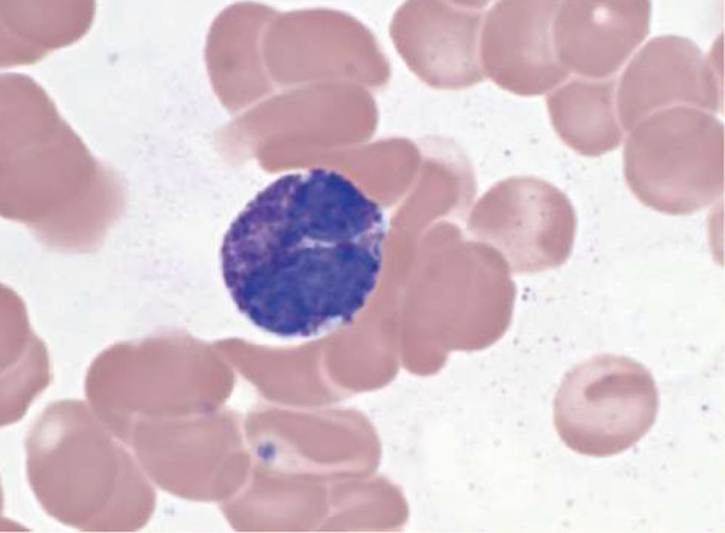 <p>Least-common WBC (0.2-1% of circulating leukocytes)</p><p>Half-life 2.5 days</p><p>Purple-staining of basophilic granules</p><p>Cytoplasm contain histamine, heparin and pro-inflammatory cytokines</p><p>Function: importance in type 1 hypersensitivity reactions (e.g. re-exposure to allergens)</p>