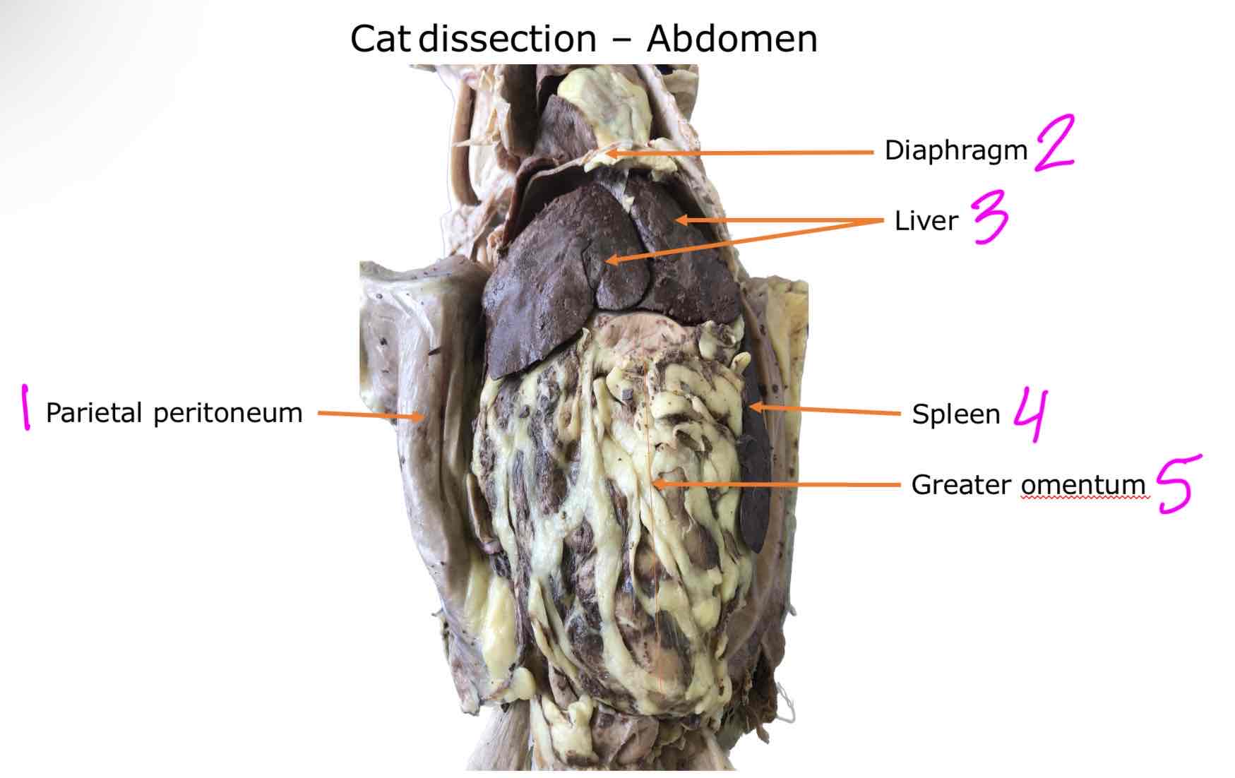<ol><li><p>Parietal peritoneum</p></li><li><p>Diaphragm </p></li><li><p>Liver</p></li><li><p>Spleen</p></li><li><p>Greater omentum</p></li></ol>