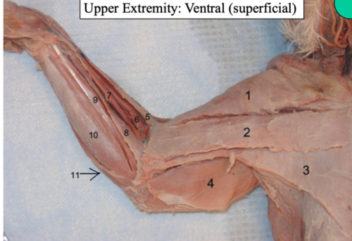 <p>what upper extremity: ventral (superficial) muscle is number 10?</p>