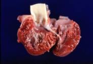 <p>Describe this texture and what is its cause?</p>