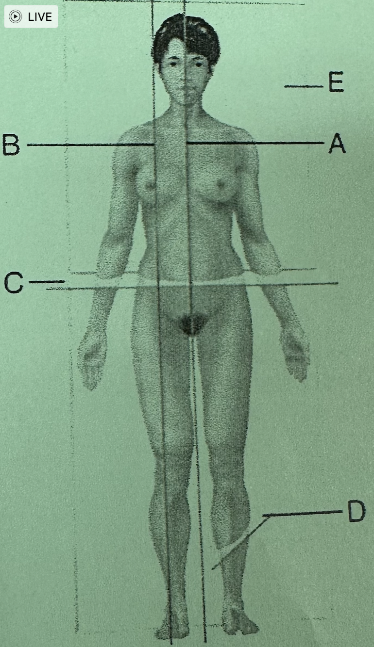 <p>B; sagittal</p>