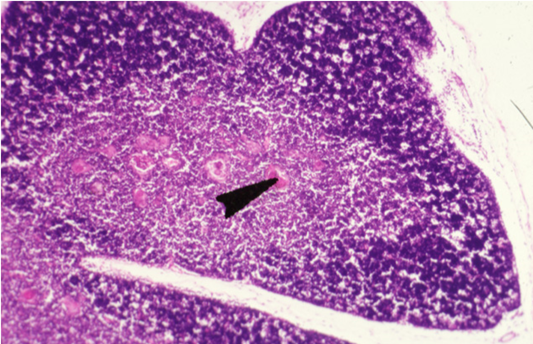 <p><strong>Thymus</strong></p><p><em>Hassall’s corpuscles present</em></p>