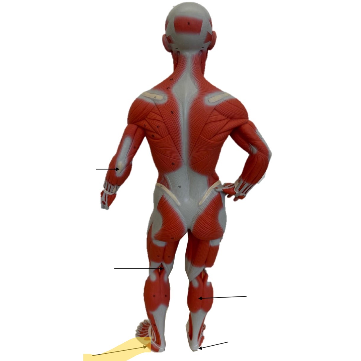 <p>Plantar</p>