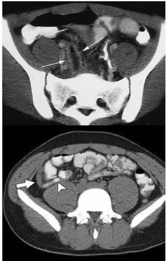 <p>What is this and what type of scan </p>