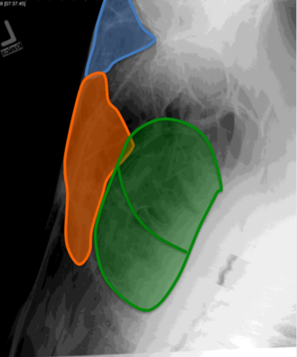 <p>label the paranasal sinus: blue</p>