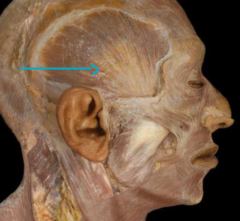 <p>what muscle?</p>