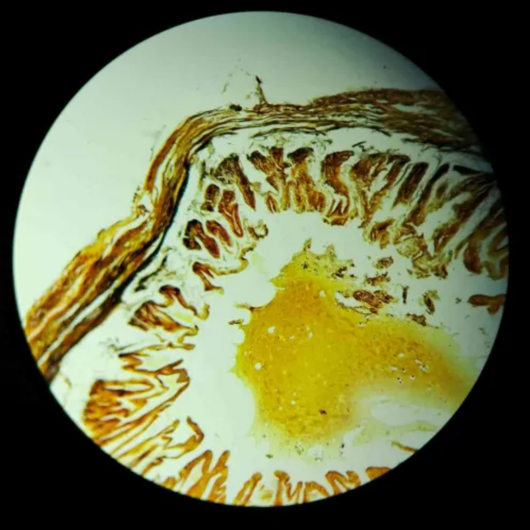 term image