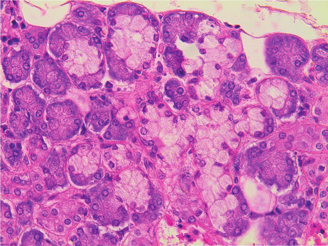 <p>6. The structures shown in the image are:</p><p>A. Scent glands (apocrine sweat glands) in the armpit</p><p>B. A section of the exocrine pancreas</p><p>C. A section of the parotid gland (Glandula parotidea)</p><p>D. A section of the submandibular gland (Glandula submandibularis)</p><p>E. Sweat glands in the deeper layer of the dermis</p>
