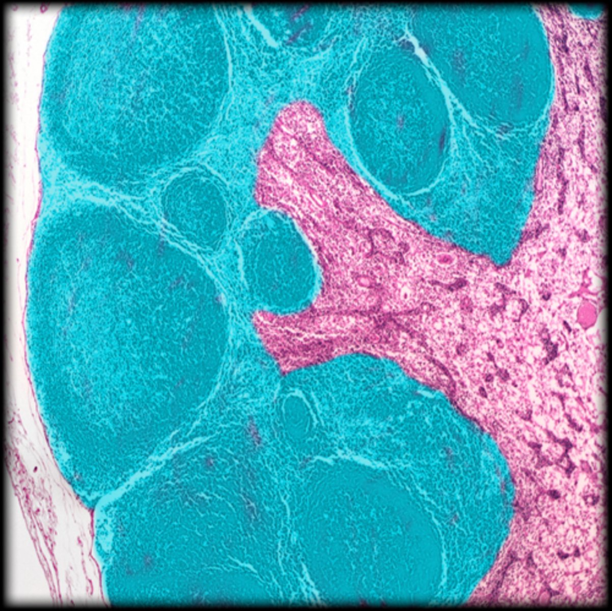 <p>Lymph node</p>