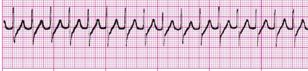 <p>What’s the rhythm?</p>