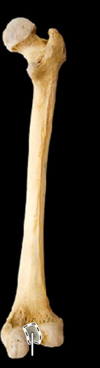 <p>Femur, posterior view, right side</p>
