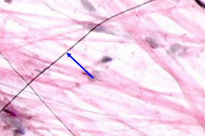 <p>What is the blue arrow pointing at?</p>