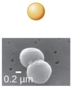 <p>What type of bacteria is this?</p>
