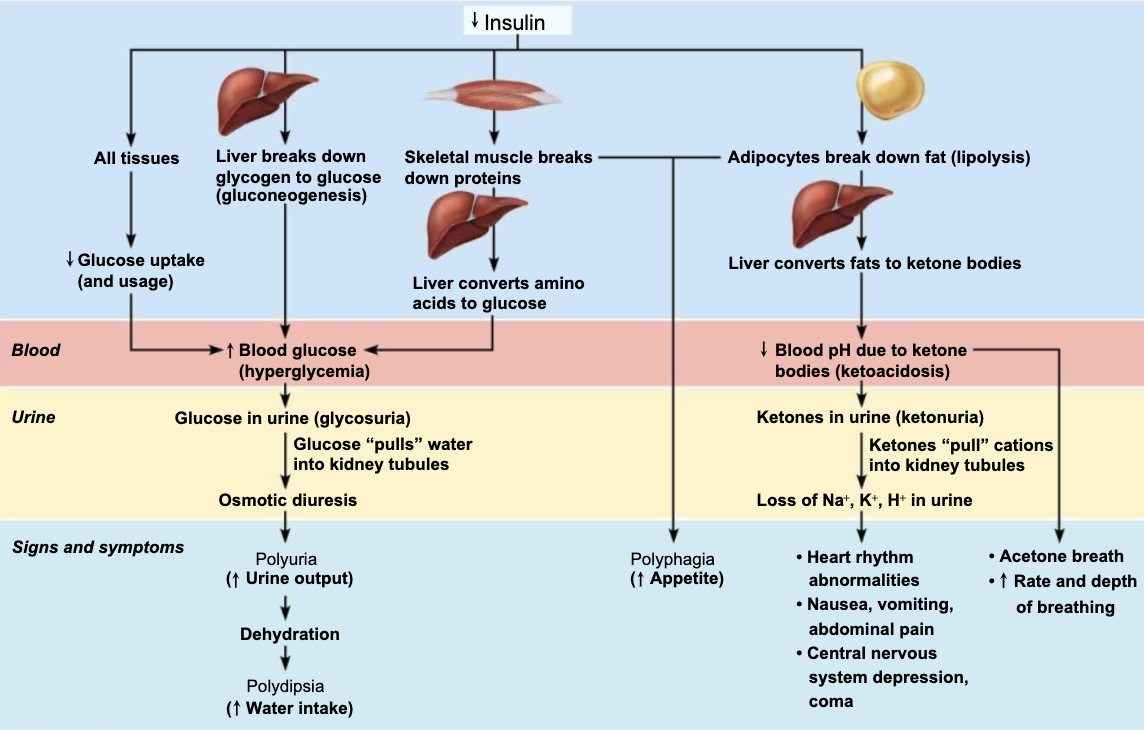 <ul><li><p>When sugar cannot be used as fuel, as in <strong>Diabetes Mellitus</strong>, fats are used, causing <strong><em>lipidemia</em></strong> → high levels of fatty acids in blood&nbsp;</p></li><li><p>Fatty acid metabolism results in formation of <strong>ketones</strong> (<strong>ketone bodies</strong>)&nbsp;</p></li><li><p>Ketones are acidic, and their build-up in blood can cause <strong>ketoacidosis</strong>&nbsp;</p><ul><li><p>Also causes ketonuria: ketone bodies in urine </p></li></ul></li></ul><p></p>