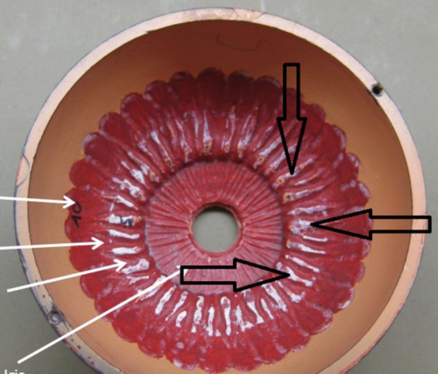 <p>black arrows; medial view</p>