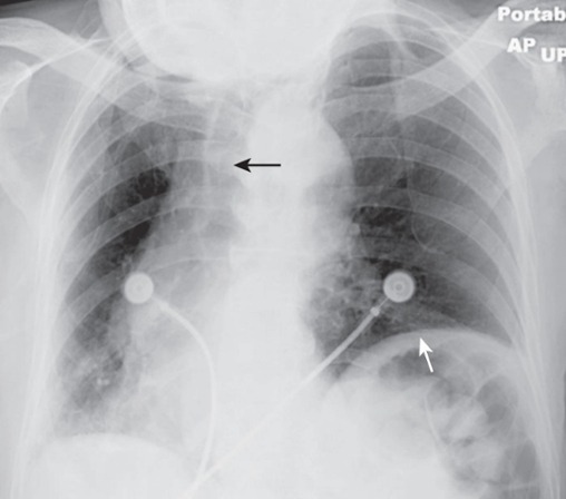 <p>Example of Rotation</p>