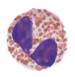 <ul><li><p>Cell has an affinity for eosin dye – red colour&nbsp;&nbsp;&nbsp;&nbsp;&nbsp;&nbsp;</p></li><li><p class="MsoListParagraphCxSpMiddle">Multilobed, but generally 2-lobed nucleus&nbsp;&nbsp;&nbsp;&nbsp;&nbsp;&nbsp; ‘</p></li><li><p class="MsoListParagraphCxSpLast">Contain dense granules that do not overlie the nucleus</p><ul><li><p class="MsoListParagraphCxSpLast">When stained appear red → acid stains </p></li></ul></li><li><p class="MsoListParagraphCxSpLast">Involved in killing large organisations e.g.worms</p></li></ul><p></p>
