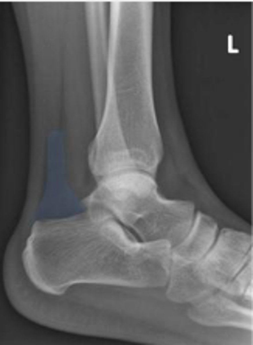 <p>What is outlined?</p>