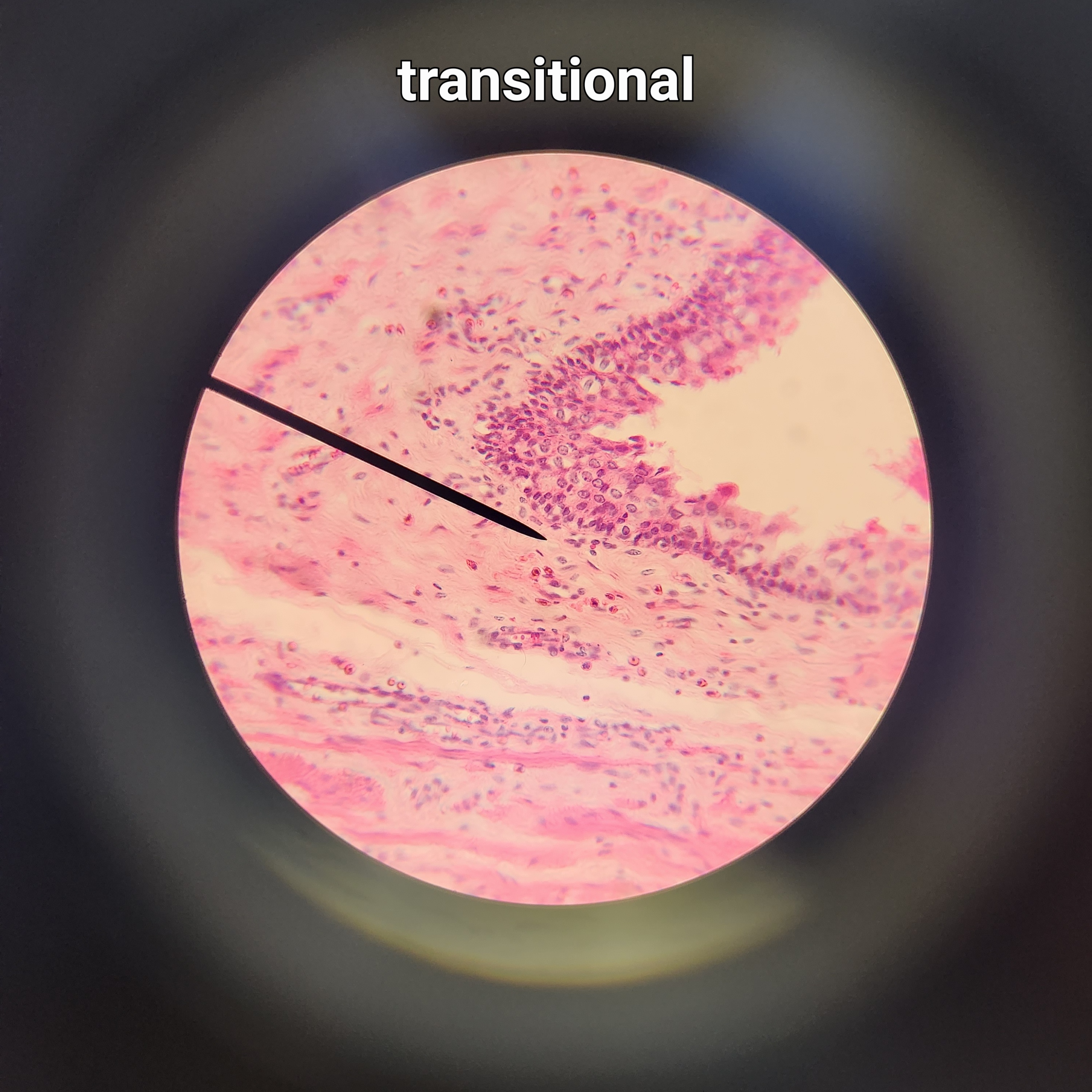 many layers of rounded, teardrop shaped cells