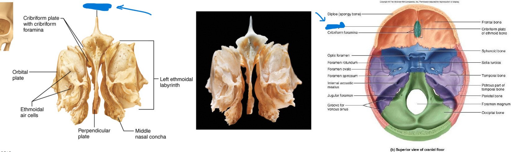 <p>What is this part of the ethmoid?</p>