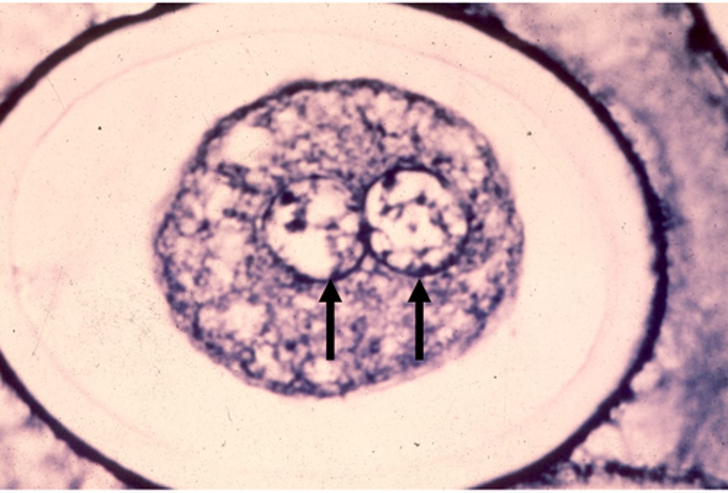 <p>The egg nucleus has completed _______ and is now ______. The sperm was already _____. Each nucleus indicated by a black arrow is now called a __________, and we cannot distinguish which nucleus is which.</p>