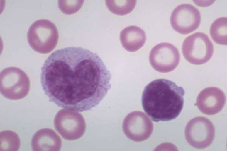 <p>The largest WBC (<span>0.2 - 0.8x10^9/L)</span>, which differentiate into macrophages and dendritic cells in tissues (~50% stored in spleen).</p><p>Have a <span>phagocytic role and antigen presenting roles.</span></p>