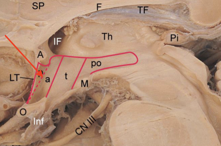 <p>region above the optic chiasm</p>