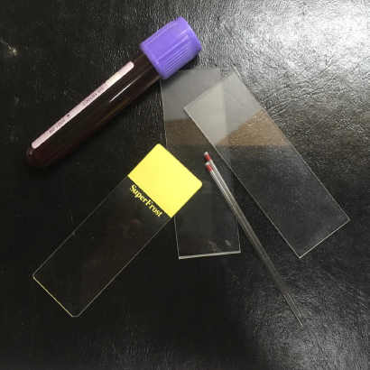 <p>Identify the method of preparing blood smear</p>