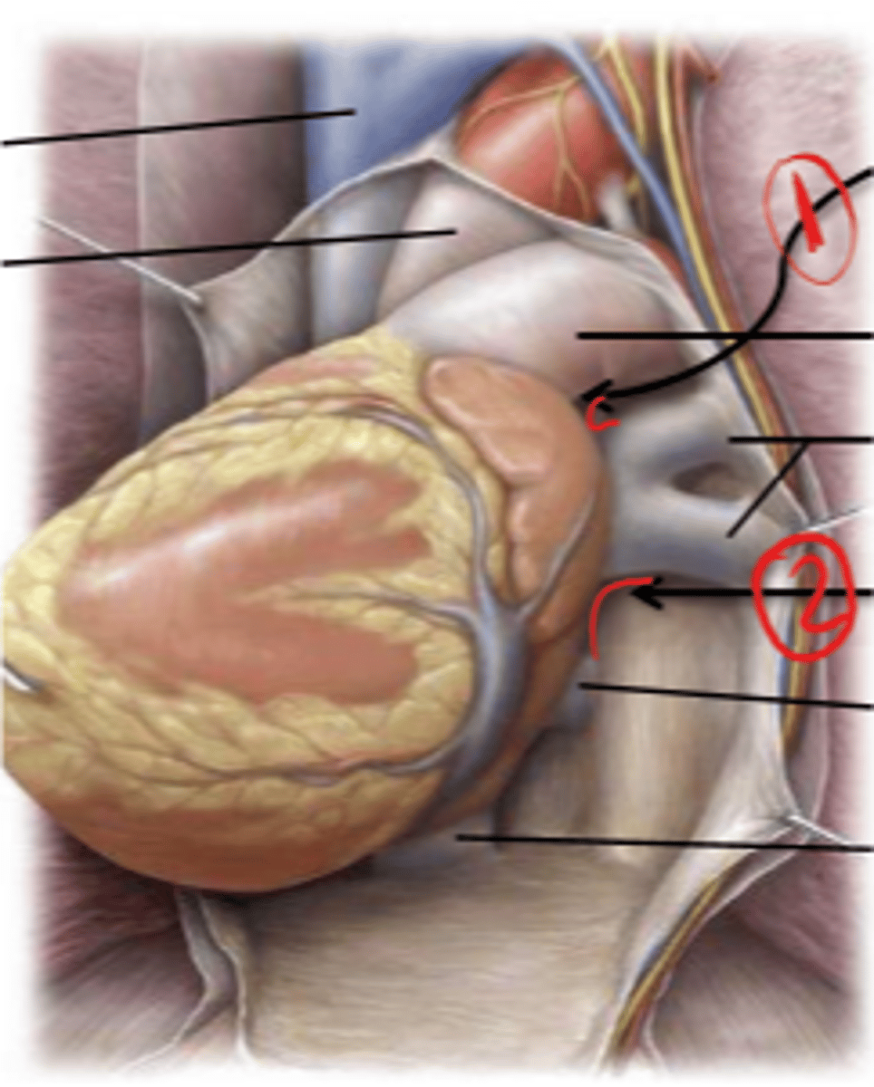 <p>Identify the space 2 - posterior to the L atrium</p>